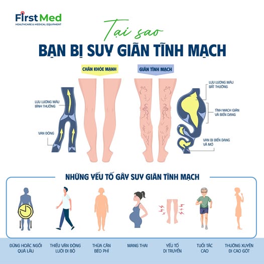 TẠI SAO BẠN BỊ SUY GIÃN TĨNH MẠCH? - First Med
